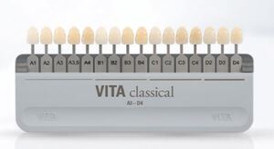 vita classical a1-d4 kleurenstaal