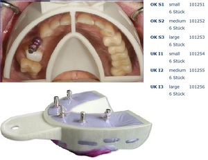 miratray implant boven small s1